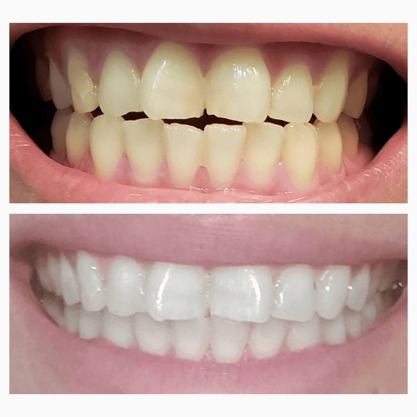 Magic Whitening Toothpaste Villcov® Powder with Hydroxyapatite - World's First & Only! Sprinkle or Dip!