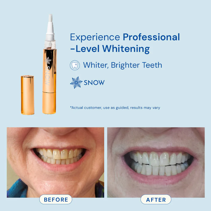 Extra-strength Whitening Gold Serum Pen Dual-peroxide Formula