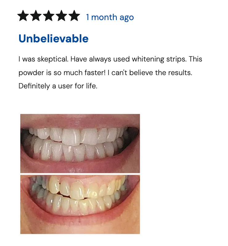 Magic Whitening Toothpaste Villcov® Powder with Hydroxyapatite - World's First & Only! Sprinkle or Dip!