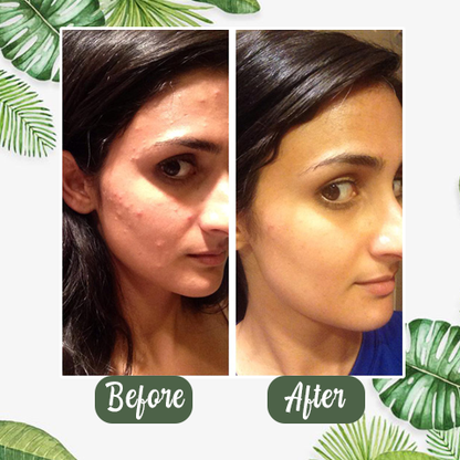 Hot Sale - Green Tea Deep Cleanse Mask cjh