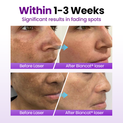 Villcov SpotErase Probiotic Shield Serum