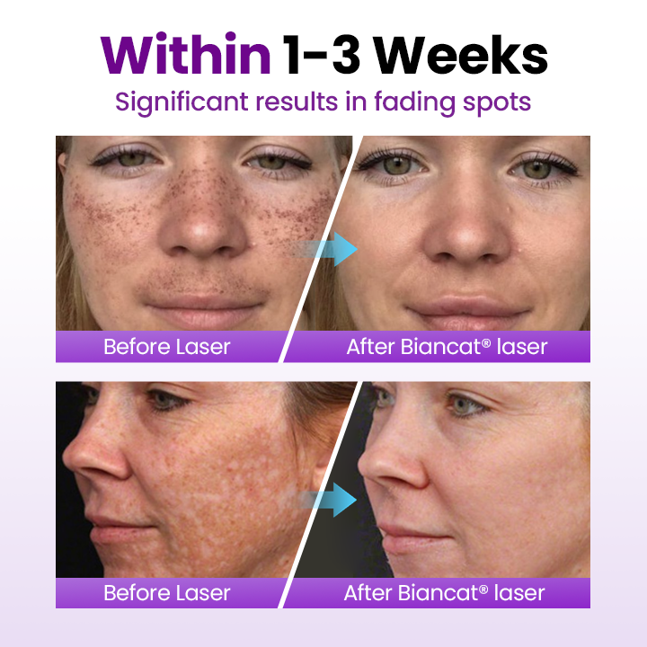 Villcov SpotErase Probiotic Shield Serum