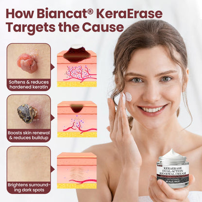KeraErase Dual-Action Renewal Cream