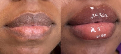 Plumping Lip filler