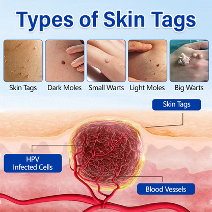 Villcov WartClear Herbal Ointment