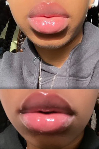 Plumping Lip filler