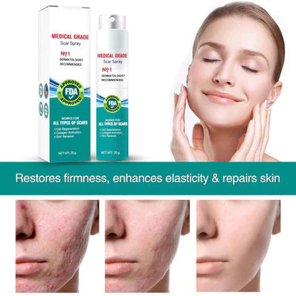 Scar Remove – Medical Grade Scar Spray(For example Acne Scars, Surgical Scars and Stretch Marks ⚡️⚡️⚡️)