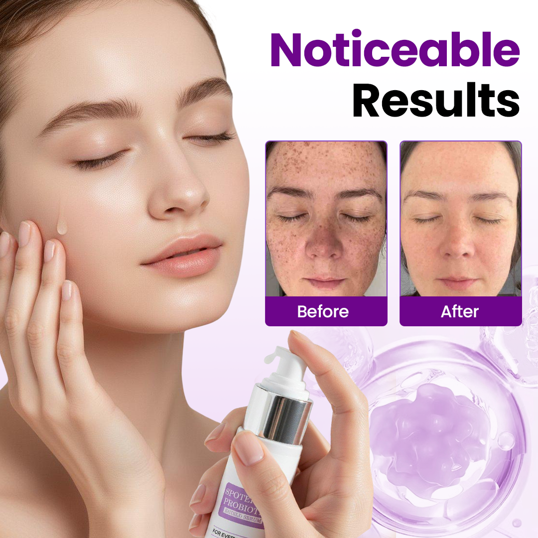 Villcov SpotErase Probiotic Shield Serum