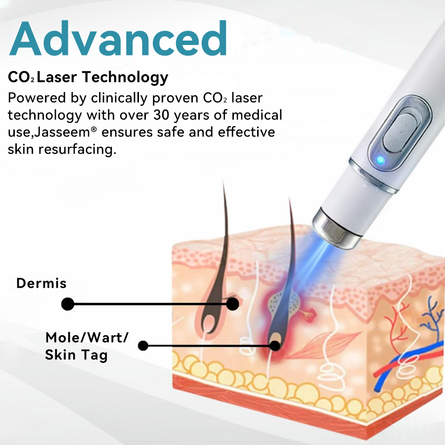Thekoec® Medical-Grade Laser Pen 🌏 (Powered by CO₂ laser technology – effectively removes moles, warts, skin tags, pigmentation spots, and other skin imperfections)🔥