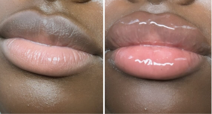 Plumping Lip filler