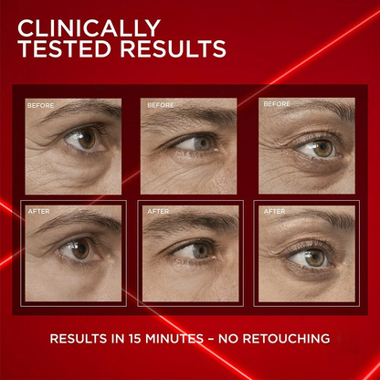 EYE BAG INSTANT ERASER – New Formula, Ultimate Lift & Smooth Finish ✨